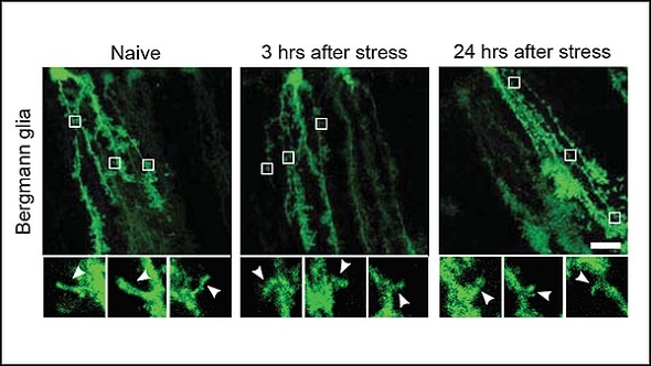 Research shows how stress restructures the brain
