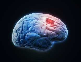 Engineers innovate soft, flexible brain implant