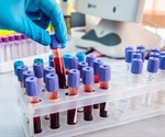 New blood test accurately detects more than 50 types of cancer
