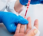 New blood test detects more than 50 types of cancer, including at early, more treatable stages