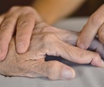 Are There Any Natural Remedies for Rheumatoid Arthritis?