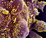 Immunity to coronavirus infection may help stem the pandemic