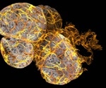 Discovery of new type of immune cell in breast ducts