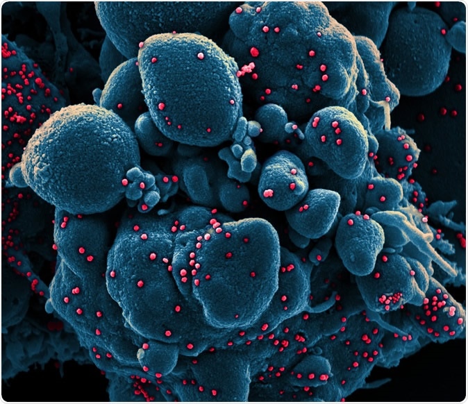 Micrografia de elétron nova da exploração de Coronavirus SARS-CoV-2 Colorized de uma pilha apoptotic (azul) contaminada com as partículas do vírus SARS-COV-2 (vermelhas), isoladas de uma amostra paciente. A imagem capturada no NIAID integrou a instalação de investigação no forte Detrick, Maryland. Crédito: NIAID