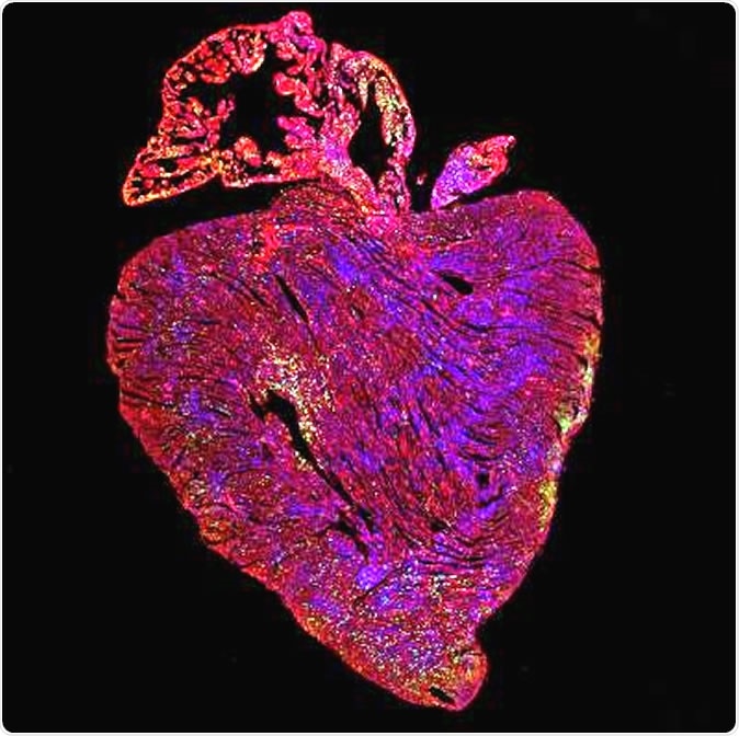 Adult mouse heart after activation of both proteins vital for cell replication. Green shows cells replicating. Image Credit: Cathy Wilson, University of Cambridge
