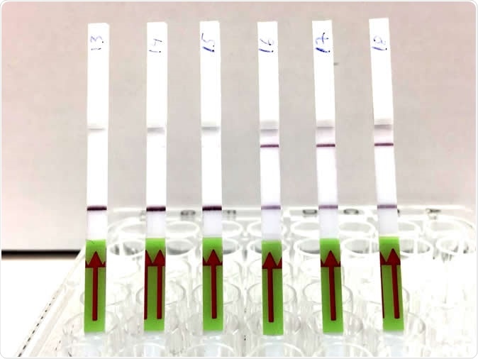 The lateral flow strips show three patient samples that are negative for BK virus (13,14,15) and three patient samples that are positive (16,17,18). Presence of the upper band indicates a positive test result. Image Credit: Michael Kaminski, MDC
