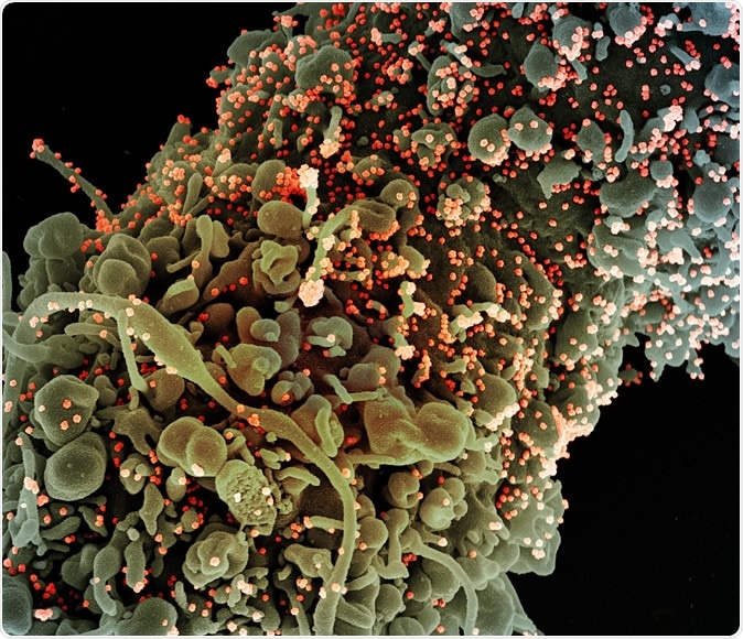 Novel Coronavirus SARS-CoV-2 Colorized scanning electron micrograph of a cell showing morphological signs of apoptosis, infected with SARS-COV-2 virus particles (orange), isolated from a patient sample. Image captured at the NIAID Integrated Research Facility (IRF) in Fort Detrick, Maryland. Credit: NIAID