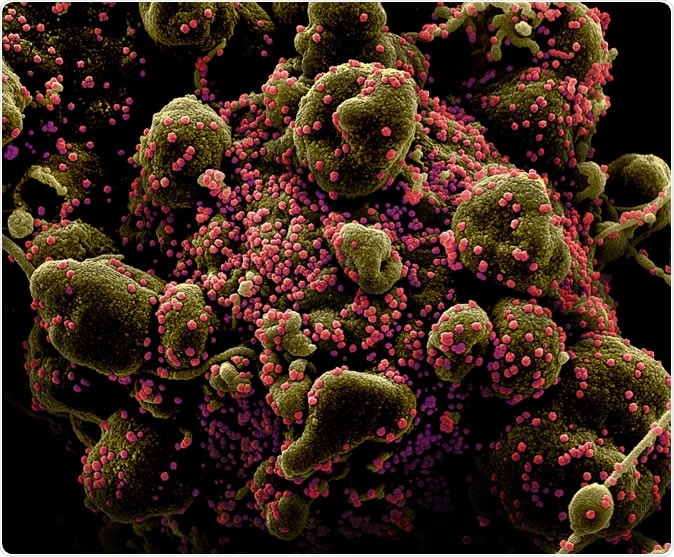 Novel Coronavirus SARS-CoV-2 Colorized scanning electron micrograph of an apoptotic cell (greenish brown) heavily infected with SARS-COV-2 virus particles (pink), isolated from a patient sample. Image captured and color-enhanced at the NIAID Integrated Research Facility (IRF) in Fort Detrick, Maryland. Credit: NIAID