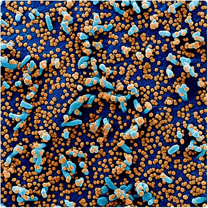 Novel Coronavirus SARS-CoV-2 Colorized scanning electron micrograph of a VERO E6 cell (blue) heavily infected with SARS-COV-2 virus particles (orange), isolated from a patient sample. Image captured and color-enhanced at the NIAID Integrated Research Facility (IRF) in Fort Detrick, Maryland. Credit: NIAID