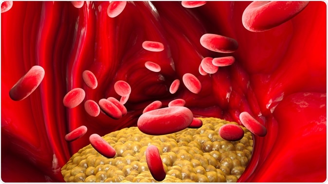 Cholesterol formation. Illustration Credit: Naeblys / Shutterstock