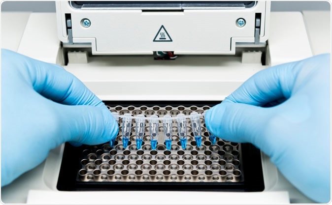 Pooling of samples for testing for SARS-CoV-2 in asymptomatic people. Image Credit: unoL / Shutterstock