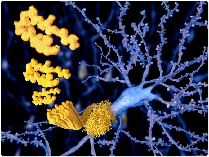 The beta amyloid peptid, amyloid plaques growing on a neuron. It consists of about 30 amino acids and aggregates to amyloid plaques, that may damage and kill neurons. Image Credit: Juan Gaertner / Shutterstock