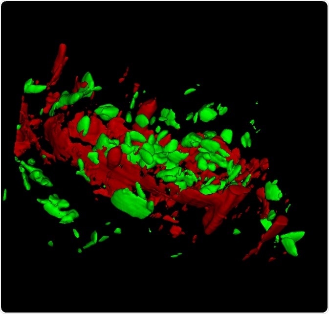 3D confocal Raman imaging measurement of banana pulp: Starch grains (green); cell wall components (red).