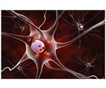 Recent Research into Neurodegenerative Diseases