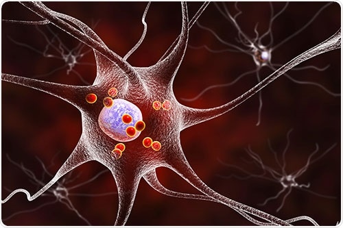 Recent Research Into Neurodegenerative Diseases