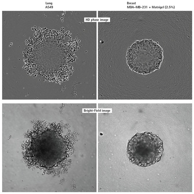Visualizing different spheroid morphologies. High quality HD phase and corresponding BF images of spheroids formed from A549 and MDAMB-231 cells (2,500 or 5000 cells per well respectively), 72 h post seeding. Visualization of detailed phenotypic variation is observed in HD phase images. A549 cells present a loose aggregate morphology compared to the compact spheroid formed by MDA-MB-231 cells. Compaction of MDA-MB-231 aggregates into spheroids was achieved by the addition of 2.5% v/v Matrigel® post centrifugation. All images captured at 10x magnification.