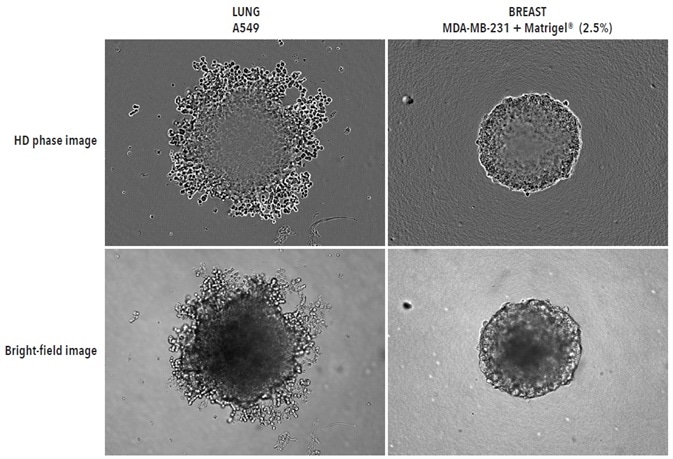 Visualizing different spheroid morphologies. High quality HD phase and corresponding BF images of spheroids formed from A549 and MDA-MB-231 cells (2,500 or 5000 cells per well respectively), 72-hours post seeding. Visualization of detailed phenotypic variation is observed in HD phase images. A549 cells present a loose aggregate morphology compared to the compact spheroid formed by MDA-MB-231 cells. Compaction of MDA-MB-231 aggregates into spheroids was achieved by the addition of 2.5% v/v Matrigel® post centrifugation. All images captured at 10x magnification.