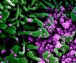 Loss of smell hints at coronavirus infection