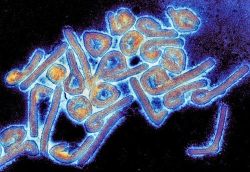 マールブルグウイルスの構造と伝染