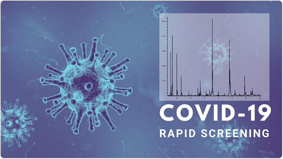 UK diagnostics firm develops rapid test to fight against COVID-19
