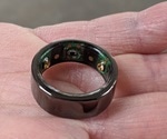 Smart ring predicts onset of COVID-19 in healthcare workers