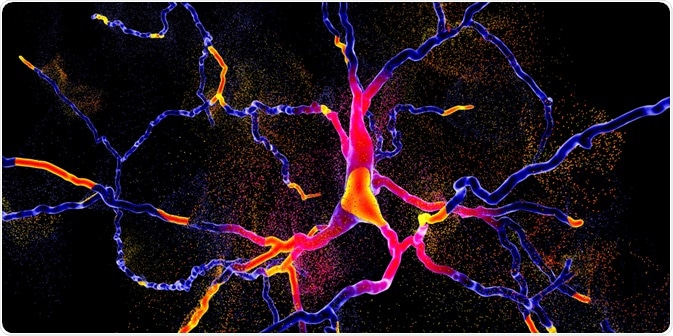 Degeneration of dopaminergic neuron