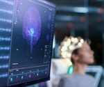 High density EEG produces dynamic image of brain signal source