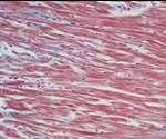 Using Microparticles to Repair and Detox Cardiac Muscle