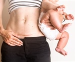 Women born by cesarean have greater risk of obesity and diabetes
