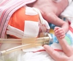 Preterm birth a risk factor for academic difficulties