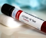 New blood test for antibodies in COVID-19 infected