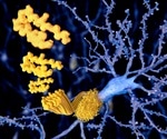 Alzheimer's disease: high amyloid levels linked to early disease
