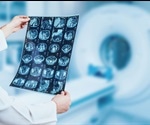 Using MRI to Diagnose Autism Spectrum Disorder