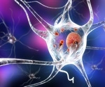 Mutated ATP1B gene a risk factor for Parkinson’s