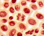 Stem cells used to combat COVID-19 pneumonia