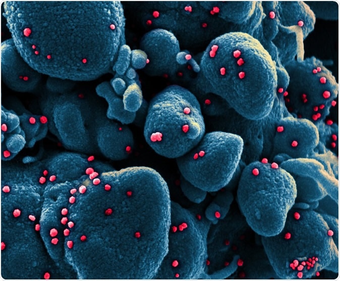 Novel Coronavirus SARS-CoV-2 Colorized scanning electron micrograph of an apoptotic cell (blue) infected with SARS-COV-2 virus particles (red), isolated from a patient sample. Image captured at the NIAID Integrated Research Facility (IRF) in Fort Detrick, Maryland. Credit: NIAID