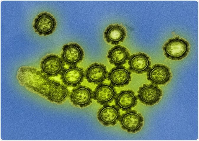 H1N1 Influenza Virus Particles Colorized transmission electron micrograph showing H1N1 influenza virus particles. Surface proteins on the virus particles are shown in black. Credit: NIAID