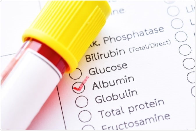 Study: Low albumin levels are associated with poorer outcomes in a case series of COVID-19 patients in Spain: a retrospective cohort study. Image Credit: Jarun Ontakrai Shutterstock