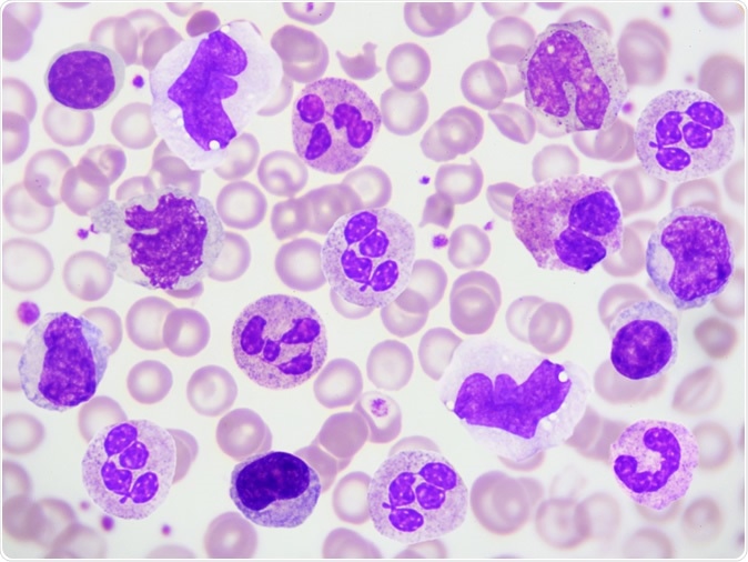 White blood cells in peripheral blood smear. Image Credit: Jarun Ontakrai / Shutterstock
