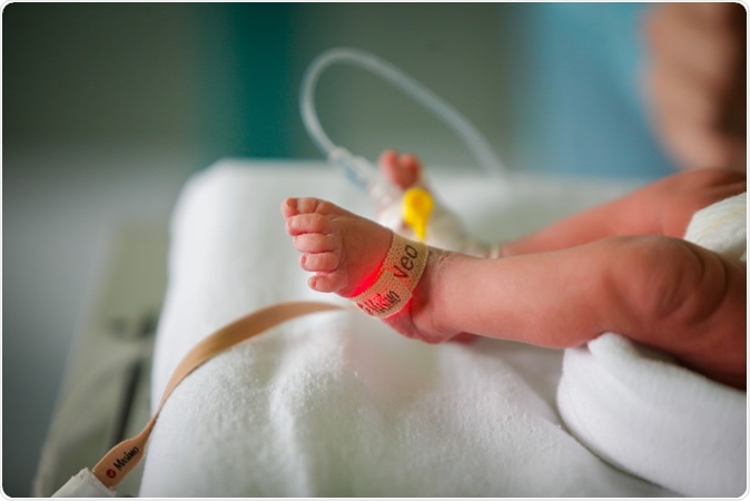 Changes in premature birth rates during the Danish nationwide COVID-19 lockdown: a nationwide register-based prevalence proportion study. Image Credit: M.Moira / Shutterstock