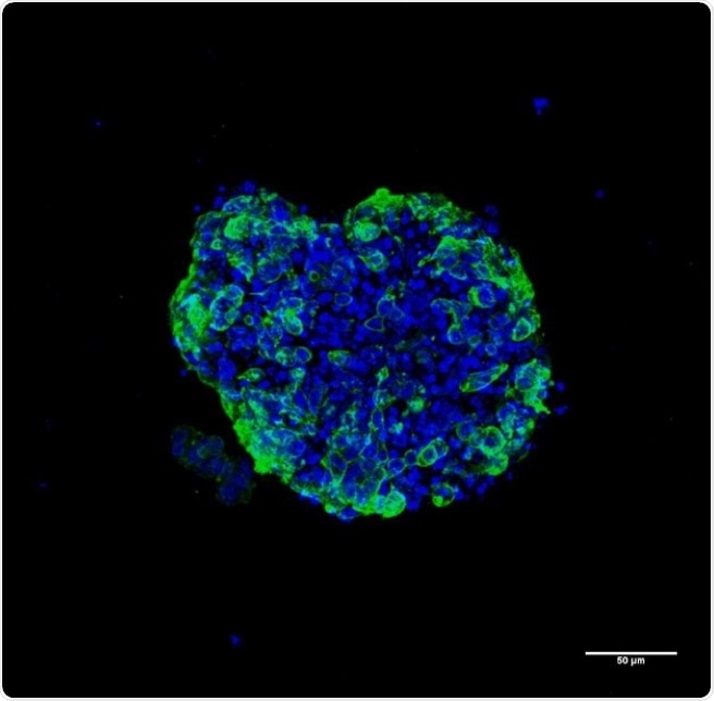 First detailed study of the epigenetic landscape of human tumor organoids