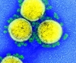 Oxford University vaccine prevents SARS-CoV-2 pneumonia in rhesus macaques