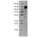 Recombinant proteins for COVID-19 research