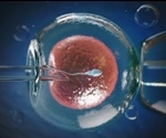 Improving IVF Treatments by Imaging Sperm Cells