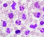 Does COVID-19 infect peripheral blood cells?