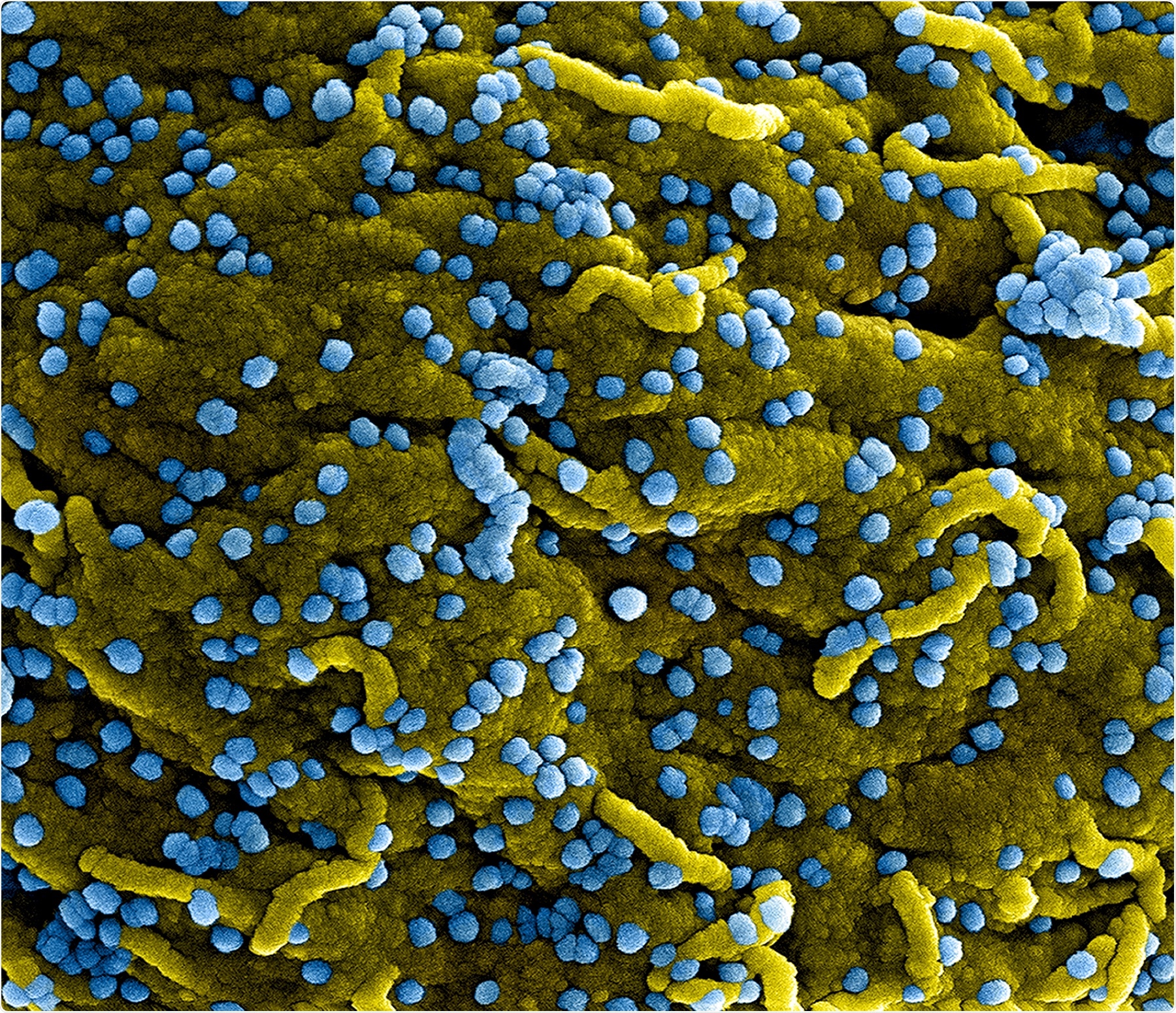 MERS Coronavirus Particles Colorized scanning electron micrograph of Marburg virus particles (blue) both budding and attached to the surface of infected VERO E6 cells (yellow). Image captured and color-enhanced at the NIAID Integrated Research Facility in Fort Detrick, Maryland. Credit: NIAID