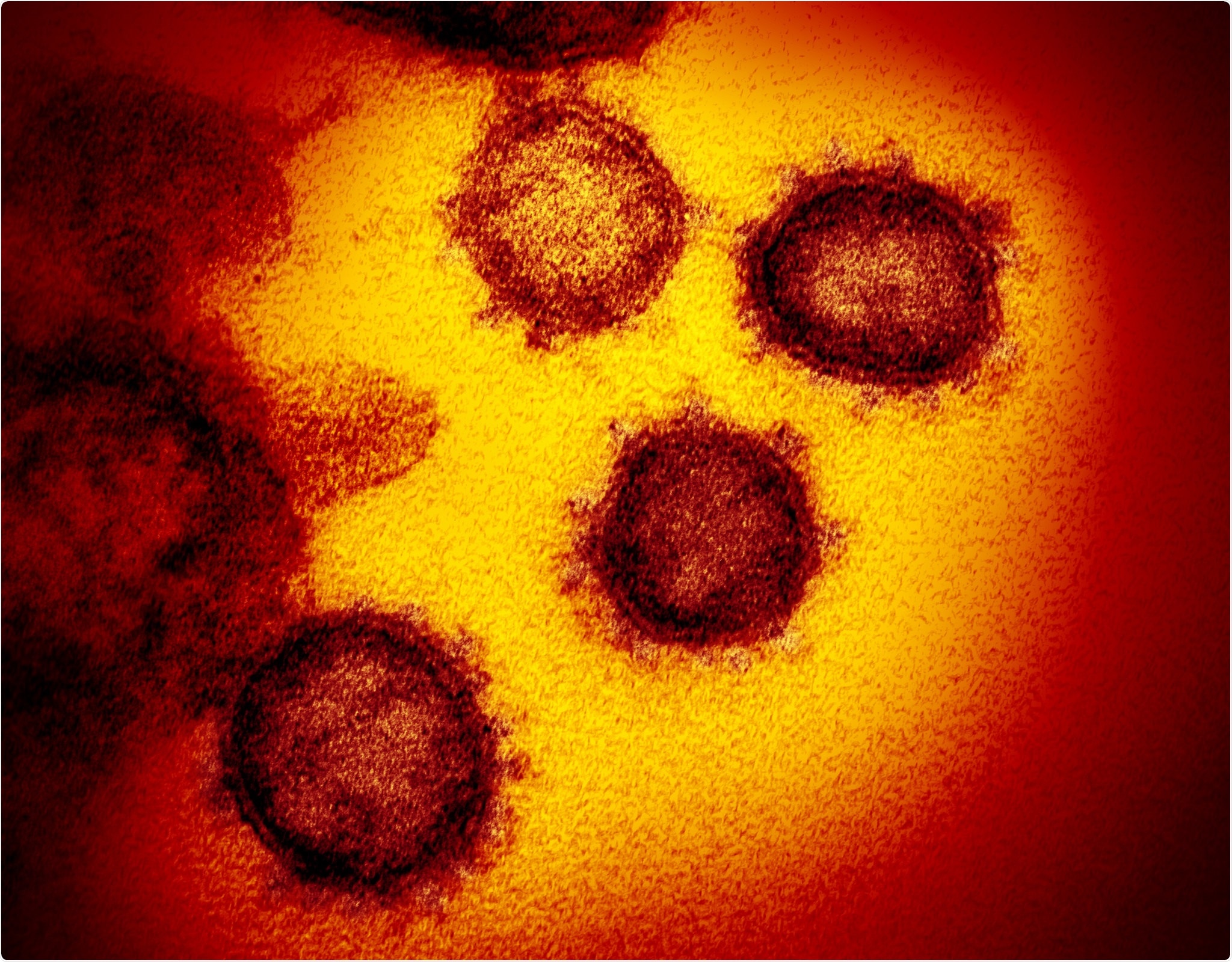 Novel Coronavirus SARS-CoV-2 This transmission electron microscope image shows SARS-CoV-2—also known as 2019-nCoV, the virus that causes COVID-19. isolated from a patient in the U.S., emerging from the surface of cells cultured in the lab.Image captured and colorized at NIAID