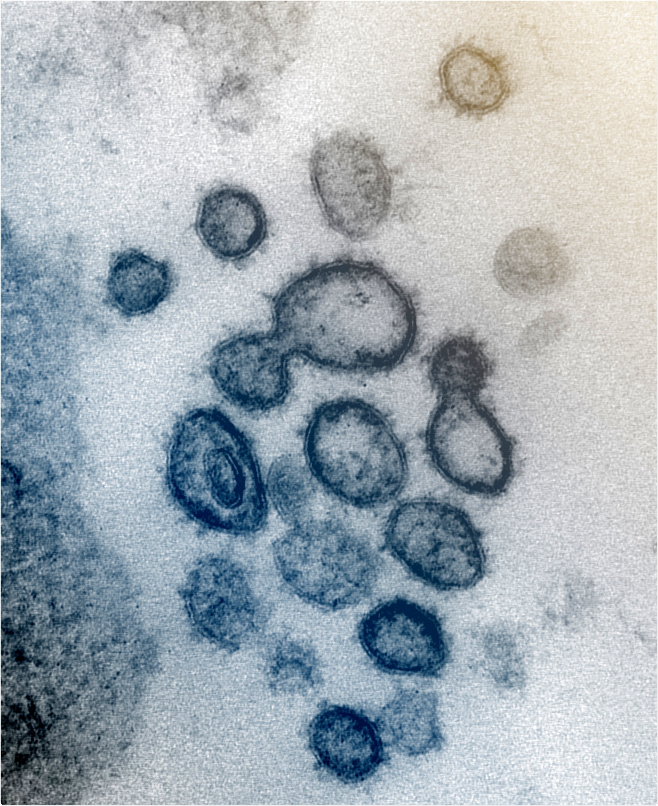 Novel Coronavirus SARS-CoV-2 This transmission electron microscope image shows SARS-CoV-2—also known as 2019-nCoV, the virus that causes COVID-19—isolated from a patient in the U.S. Virus particles are shown emerging from the surface of cells cultured in the lab. The spikes on the outer edge of the virus particles give coronaviruses their name, crown-like.Image captured and colorized at NIAID