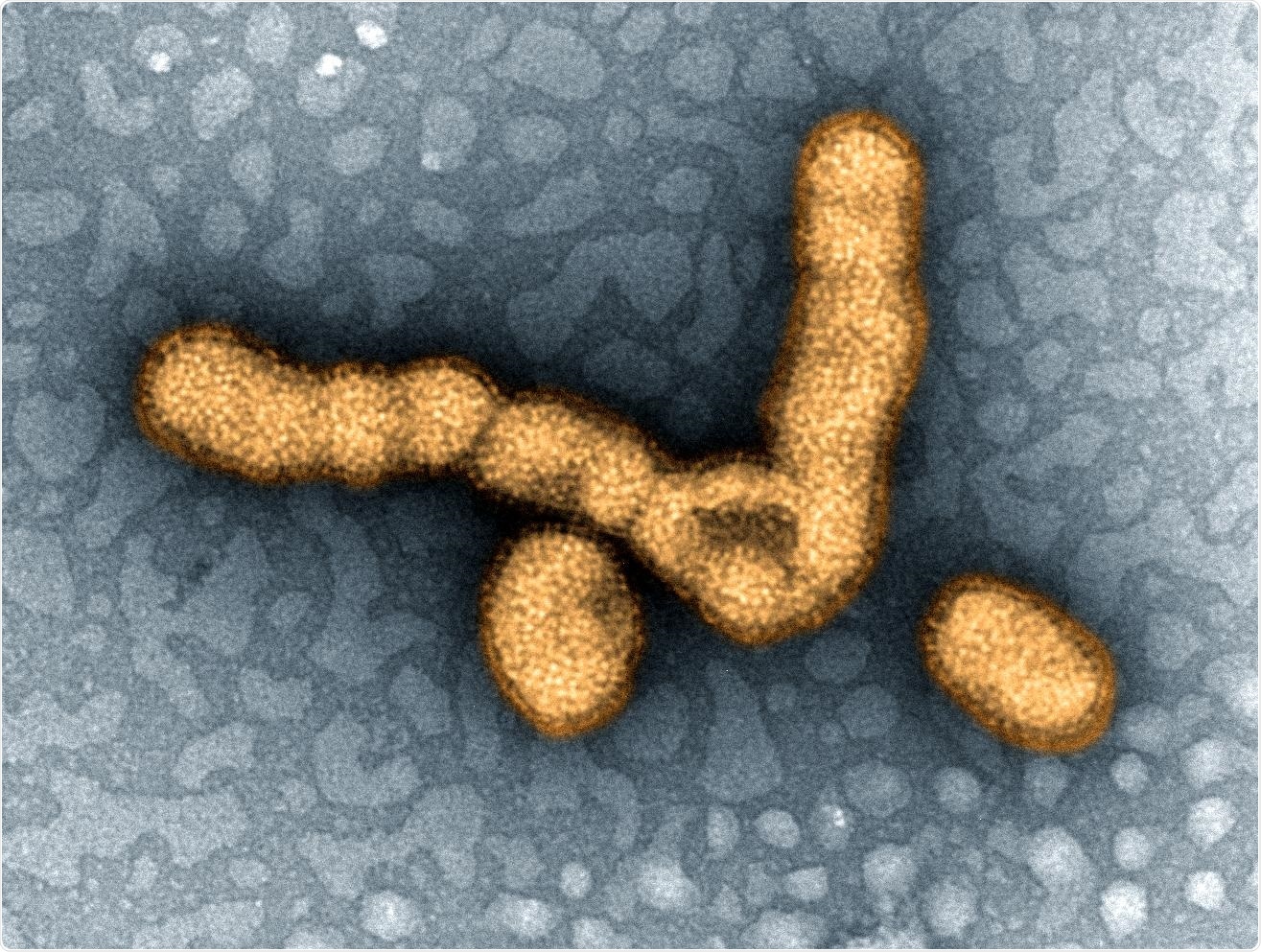 H1N1 Influenza Virus Particles Colorized transmission electron micrograph showing H1N1 influenza virus particles. Credit: NIAID