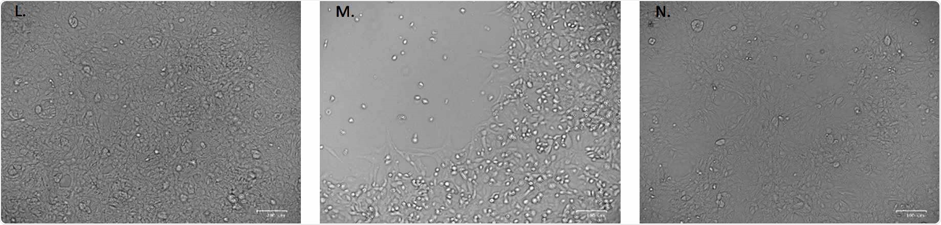 No cytopathic effect was observed in uninfected cultured VeroE6 monolayers maintained in 50mJ/cm2 UVTtreated complete medium for 72 hours. (M) In vitro infection of SARSTCoVT2 (5 MOI) UVTC untreated VeroE6 cells resulted in an evident cytopathic effect. (N) SARST CoVT2 irradiation with 3.7 mJ/cm2 UVTC rescued the cytopathic effect induced by UVTC untreated virus.